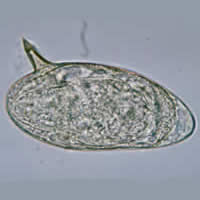 Schistosoma Mansoni Egg